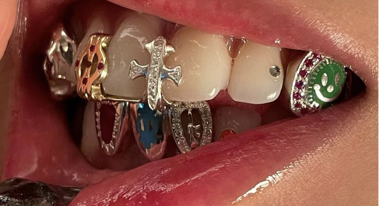 Dental Grillz Became The Luxe Smile Statement