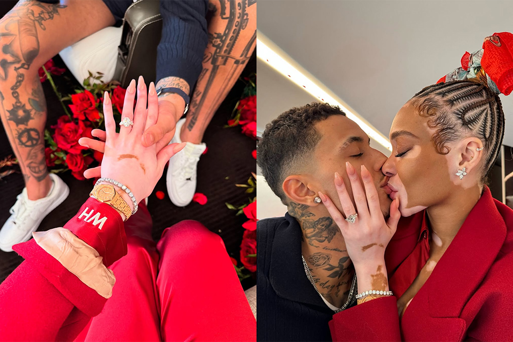 Winnie Harlow,Winnie Harlow & Kyle Kuzma,most expensive celebrity engagement rings,celebrity engagement rings 2025,